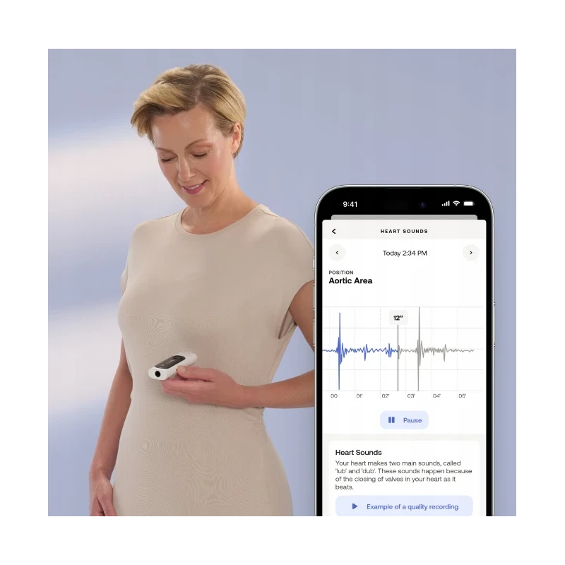 Withings BeamO - multifunkcyjne urządzenie do kontrolowania stanu zdrowia (termometr, pulsoksymetr, EKG, cyfrowy stetoskop). Wyr